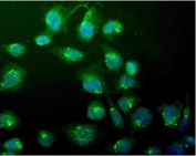 Immunofluorescent staining of FFPE human U-2 OS cells with Wee1 antibody (green) and DAPI nuclear stain (blue). HIER: steam section in pH6 citrate buffer for 20 min.