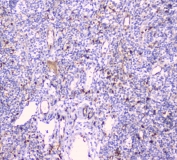 IHC staining of FFPE human tonsil with CDA antibody at 1ug/ml. HIER: boil tissue sections in pH6, 10mM citrate buffer, for 10-20 min and allow to cool before testing.