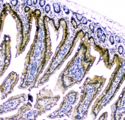 IHC staining of FFPE mouse intestine with CDA antibody at 1ug/ml. HIER: boil tissue sections in pH6, 10mM citrate buffer, for 10-20 min and allow to cool before testing.