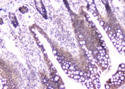 IHC staining of FFPE rat intestine with CDA antibody at 1ug/ml. HIER: boil tissue sections in pH6, 10mM citrate buffer, for 10-20 min and allow to cool before testing.