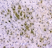 IHC staining of FFPE rat brain with CDA antibody at 1ug/ml. HIER: boil tissue sections in pH6, 10mM citrate buffer, for 10-20 min and allow to cool before testing.
