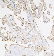 IHC staining of FFPE human placenta with Caspase 3 antibody. HIER: boil tissue sections in pH8 EDTA for 20 min and allow to cool before testing.