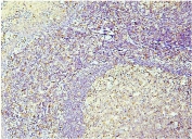 IHC staining of FFPE human tonsil with Caspase 3 antibody. HIER: boil tissue sections in pH8 EDTA for 20 min and allow to cool before testing.
