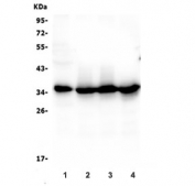 Western blot testing of human 1) placenta, 2) K562, 3) HepG2 and 4) Raji cell lysate with Caspase 3 antibody.
