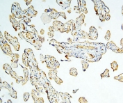 IHC staining of FFPE human placenta with Caspase 3 antibody. HIER: boil tissue sections in pH8 EDTA for 20 min and allow to cool before testing.