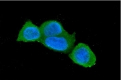 Immunofluorescent staining of FFPE human MCF7 cells with Caspase 3 antibody (green) and DAPI nuclear stain (blue). HIER: steam section in pH6 citrate buffer for 20 min.