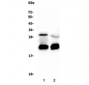 Western blot testing of 1) human placenta and 2) human SW579 lysate with Caspase 3 antibody. The pro form is seen at ~32kD and active caspase-3 seen at ~17 kDa and ~12 kDa.