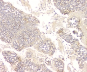 IHC staining of FFPE human tonsil with CCR10 antibody at 1ug/ml. HIER: boil tissue sections in pH6, 10mM citrate buffer, for 10-20 min and allow to cool before testing.