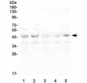 Western blot testing of human 1) HeLa, 2) K562, 3) PC-3, 4) A549 and 5) T-47D lysate with CCR10 antibody at 0.5ug/ml. Predicted molecular weight ~38 kDa.