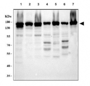 Western blot testing of 1) human HeLa, 2) human U-87 MG, 3) human SH-SY5Y, 4) rat brain, 5) rat C6, 6) mouse brain and 7) mouse Neuro-2a cell lysate with BAG6 antibody. Predicted molecular weight ~119 kDa but observed at 150-170 kDa.