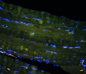 IHC staining of FFPE human skeletal muscle with Caveolin-3 antibody at 1ug/ml (green) and DAPI nuclear stain (blue). HIER: boil tissue sections in pH6, 10mM citrate buffer, for 10-20 min and allow to cool before testing.