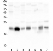 Western blot testing of 1) human placenta, 2) U-87 MG, 3) human HeLa, 4) rat stomach, 5) rat testis, 6) mouse stomach and 7) mouse testis lysate with Caveolin-3 antibody at 0.5ug/ml. Predicted molecular weight: ~17 kDa but routinely observed at 20~25 kDa.