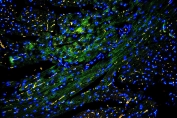 IHC staining of FFPE mouse heart with Caveolin-3 antibody at 1ug/ml (green) and DAPI nuclear stain (blue). HIER: boil tissue sections in pH6, 10mM citrate buffer, for 10-20 min and allow to cool before testing.