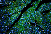 IHC staining of FFPE rat heart with Caveolin-3 antibody at 1ug/ml (green) and DAPI nuclear stain (blue). HIER: boil tissue sections in pH6, 10mM citrate buffer, for 10-20 min and allow to cool before testing.