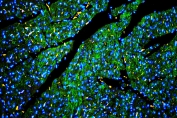 IHC staining of FFPE rat heart with Caveolin-3 antibody at 1ug/ml (green) and DAPI nuclear stain (blue). HIER: boil tissue sections in pH6, 10mM citrate buffer, for 10-20 min and allow to cool before testing.