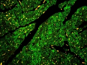 IHC staining of FFPE rat heart with Caveolin-3 antibody at 1ug/ml. HIER: boil tissue sections in pH6, 10mM citrate buffer, for 10-20 min and allow to cool before testing.