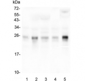 Western blot testing of human 1) placenta, 2) HepG2, 3) T-47D, 4) HeLa and 5) monkey COS-7 lysate with RHOB antibody at 0.5ug/ml. Predicted molecular weight ~22 kDa.