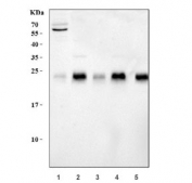 Western blot testing of 1) human HeLa, 2) rat brain, 3) rat C6, 4) mouse brain and 5) monkey COS-7 lysate with RHOB antibody at 0.5ug/ml. Predicted molecular weight ~22 kDa.