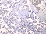 IHC staining of FFPE human placenta with TEK antibody at 1ug/ml. HIER: boil tissue sections in pH6, 10mM citrate buffer, for 10-20 min and allow to cool before testing.