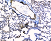 IHC staining of FFPE mouse lung with TEK antibody at 1ug/ml. HIER: boil tissue sections in pH6, 10mM citrate buffer, for 10-20 min and allow to cool before testing.