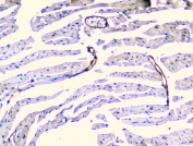 IHC staining of FFPE mouse heart with TEK antibody at 1ug/ml. HIER: boil tissue sections in pH6, 10mM citrate buffer, for 10-20 min and allow to cool before testing.