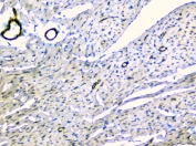 IHC staining of FFPE rat heart with TEK antibody at 1ug/ml. HIER: boil tissue sections in pH6, 10mM citrate buffer, for 10-20 min and allow to cool before testing.