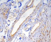 IHC staining of frozen human placenta with Caveolin-1antibody.