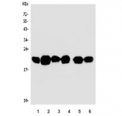 Western blot testing of human 1) HeLa, 2) A549, 3) placenta, 4) U-87 MG, 5) PC-3 and 6) U-2 OS lysate with Calveolin-1 antibody. Predicted molecular weight ~21 kDa.