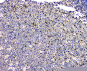 IHC staining of FFPE human tonsil tissue with PTPN11 antibody, HRP-secondary and DAB substrate. HIER: boil tissue sections in pH8 EDTA for 20 min and allow to cool before testing.