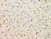 IHC staining of FFPE rat brain tissue with PTPN11 antibody, HRP-secondary and DAB substrate. HIER: boil tissue sections in pH8 EDTA for 20 min and allow to cool before testing.
