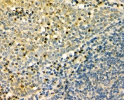 IHC staining of FFPE human tonsil with GM130 antibody. HIER: boil tissue sections in pH8 EDTA for 20 min and allow to cool before testing.