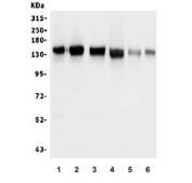 Western blot testing of human 1) placenta, 2) K562, 3) Caco-2, 4) A549, 5) A431 and 6) HEK293 cell lysate with GM130 antibody. Predicted molecular weight ~130 kDa.