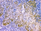 IHC staining of FFPE human tonsil with NFIA antibody. HIER: boil tissue sections in pH8 EDTA for 20 min and allow to cool before testing.