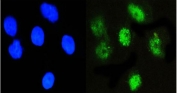 Immunofluorescent staining of FFPE human A431 cells with NFIA antibody (green) and DAPI nuclear stain (blue). HIER: steam section in pH6 citrate buffer for 20 min.