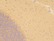 IHC staining of FFPE rat brain with PPA1 antibody at 1ug/ml. HIER: boil tissue sections in pH6, 10mM citrate buffer, for 10-20 min and allow to cool before testing.