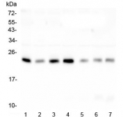 Western blot testing of human 1) placenta, 2) A549, 3) U-87 MG, 4) PC-3, 5) HeLa, 6) Caco-2 and 7) HL-60 lysate with RAB11B antibody at 0.5ug/ml. Predicted molecular weight ~24 kDa.