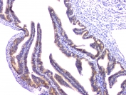 IHC staining of FFPE rat ovary with RAB11B antibody at 1ug/ml. HIER: boil tissue sections in pH6, 10mM citrate buffer, for 10-20 min and allow to cool before testing.