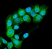Immunofluorescent staining of FFPE human A431 cells with RAB11B antibody (green) and DAPI nuclear stain (blue). HIER: steam section in pH6 citrate buffer for 20 min.