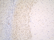 IHC staining of FFPE rat brain with TAF12 antibody at 1ug/ml. HIER: boil tissue sections in pH6, 10mM citrate buffer, for 10-20 min and allow to cool before testing.
