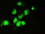 IF/ICC staining of FFPE human A431 cells with DOK7 antibody at 2ug/ml. HIER: steam section in pH6 citrate buffer for 20 min.