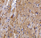 IHC staining of FFPE rat heart tissue with DOK7 antibody. HIER: boil tissue sections in pH8 EDTA for 20 min and allow to cool before testing.