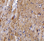 IF/ICC staining of FFPE human A431 cells with DOK7 antibody at 2ug/ml. HIER: steam section in pH6 citrate buffer for 20 min.