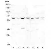 Western blot testing of 1) human HeLa, 2) human PC-3, 3) human HL-60, 4) rat skeletal muscle, 5) rat heart, 6) mouse skeletal muscle and 7) mouse heart lysate with DOK7 antibody at 0.5ug/ml. Predicted molecular weight ~53 kDa, observed here at ~65 kDa.
