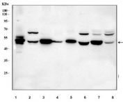 Western blot testing of 1) rat skeletal muscle, 2) rat brain, 3) rat heart, 4) rat L6, 5) mouse skeletal muscle, 6) mouse brain, 7) mouse heart and 8) mouse C2C12 cell lysate with DOK7 antibody. Predicted molecular weight ~53 kDa.