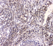 IHC staining of FFPE human lung tissue with HECTD3 antibody at 1ug/ml. HIER: boil tissue sections in pH6, 10mM citrate buffer, for 10-20 min and allow to cool before testing.