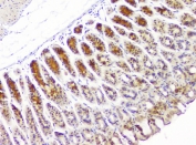 IHC staining of FFPE human stomach tissue with HECTD3 antibody at 1ug/ml. HIER: boil tissue sections in pH6, 10mM citrate buffer, for 10-20 min and allow to cool before testing.