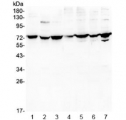 Western blot testing of human 1) A431, 2) K562, 3) A549, 4) PC-3, 5) U-2 OS, 6) Caco-2 and 7) HEK293 lysate with DARS2 antibody at 0.5ug/ml. Predicted molecular weight ~74 kDa.
