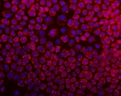 Immunofluorescent staining of FFPE human A431 cells with DARS2 antibody (red) at 2ug/ml and DAPI nuclear stain (blue). HIER: steam section in pH6 citrate buffer for 20 min.