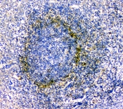 IHC staining of FFPE human tonsil tissue with IL-34 antibody at 1ug/ml. HIER: boil tissue sections in pH6, 10mM citrate buffer, for 10-20 min and allow to cool before testing.