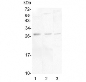 Western blot testing of 1) human placenta, 2) rat brain and 3) mouse brain lysate with IL-34 antibody at 0.5ug/ml. Predicted molecular weight ~26 kDa, secreted as an ~39 kDa homodimer that may be glycosylated.